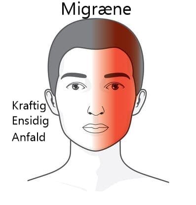 Migræne billede med placering og beskrivelse