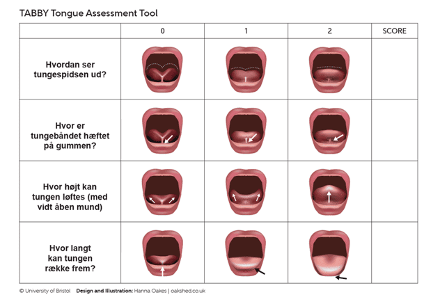 Tabby score stramt tungebånd